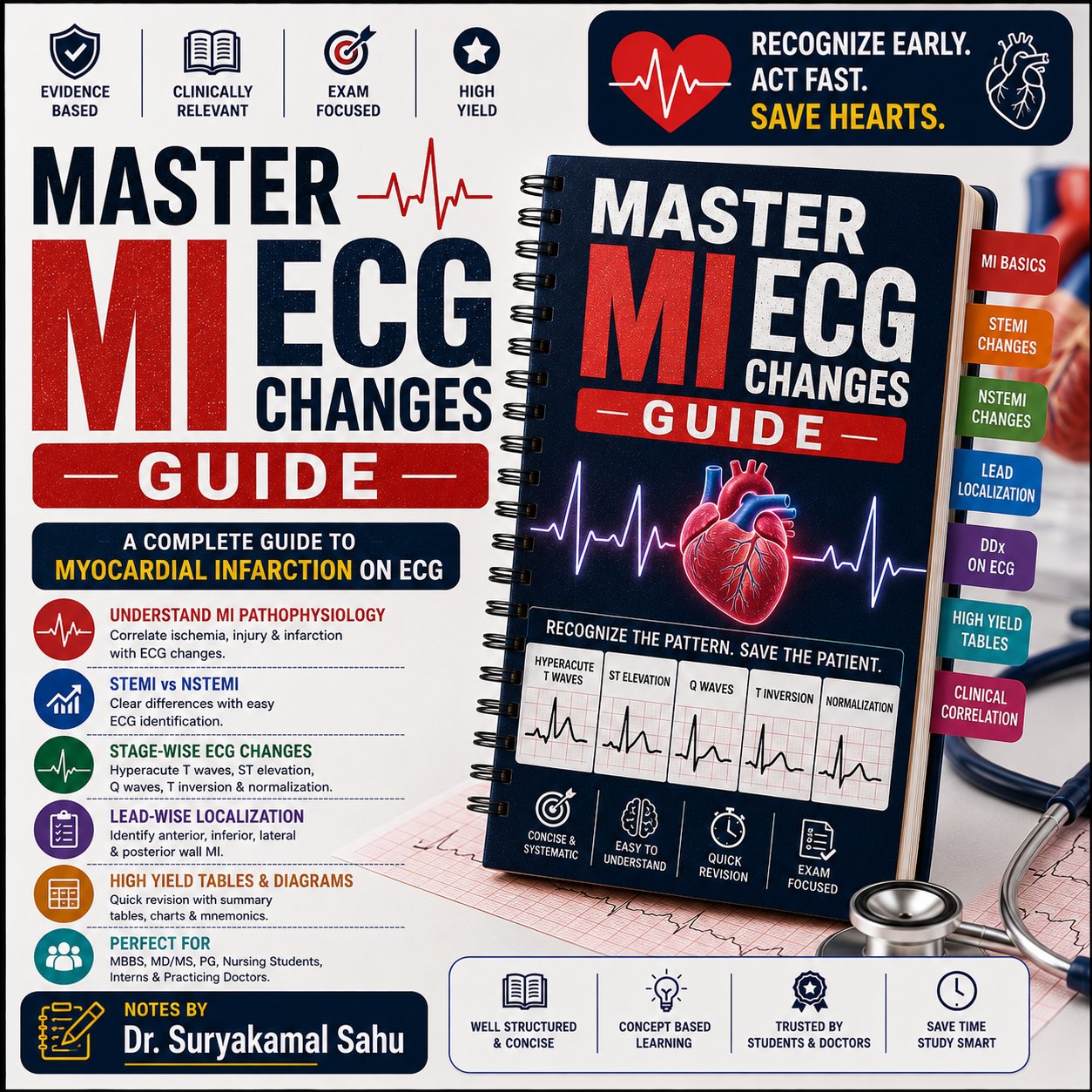 MI ECG Changes Guide